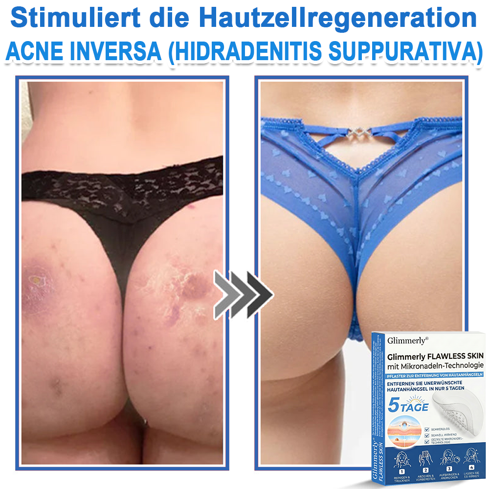 👩‍⚕️ Glimmerly® 2-in-1 Mikronadel- & Hydrokolloid-Pflaster ❄️ Entferner für erhabene Muttermale, Akne, flache Warzen & Hautanhängsel | Verbessert Falten, Narben & Hautunreinheiten | Unsichtbare Stern-Pickelpflaster für Gesicht & Körper