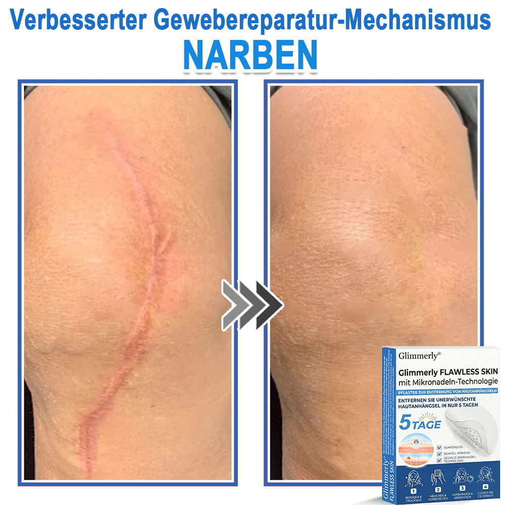 👩‍⚕️ Glimmerly® 2-in-1 Mikronadel- & Hydrokolloid-Pflaster ❄️ Entferner für erhabene Muttermale, Akne, flache Warzen & Hautanhängsel | Verbessert Falten, Narben & Hautunreinheiten | Unsichtbare Stern-Pickelpflaster für Gesicht & Körper