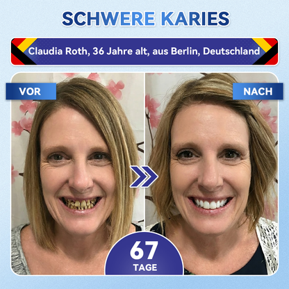 🎁 Nur noch 10 Packungen verfügbar!  𝐆𝐥𝐢𝐦𝐦𝐞𝐫𝐥𝐲® – Sichern Sie sich heute exklusiv 30 % Rabatt!