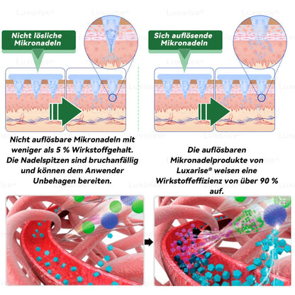 ✅👩‍🔬Einmal täglich, sichtbare Veränderungen in 7 Tagen Luxarise® Moringa · Berberin 10-in-1 fortschrittliches Nano-Mikronadel-Pflaster  Übergewicht, Diabetes, Schlafapnoe und Gelenkprobleme