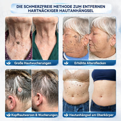 𝐏𝐢𝐜𝐝𝐨® 🥇 𝟕-𝐓𝐚𝐠𝐞 𝐇𝐚𝐮𝐭𝐚𝐧𝐡ä𝐧𝐠𝐬𝐞𝐥- & 𝐅𝐥𝐞𝐜𝐤𝐞𝐧-𝐄𝐧𝐭𝐟𝐞𝐫𝐧𝐮𝐧𝐠𝐬𝐜𝐫𝐞𝐦𝐞 (𝐒𝐜𝐡𝐦𝐞𝐫𝐳𝐟𝐫𝐞𝐢𝐞 𝐅𝐨𝐫𝐦𝐞𝐥 – 𝐨𝐡𝐧𝐞 𝐍𝐚𝐫𝐛𝐞𝐧)🔥