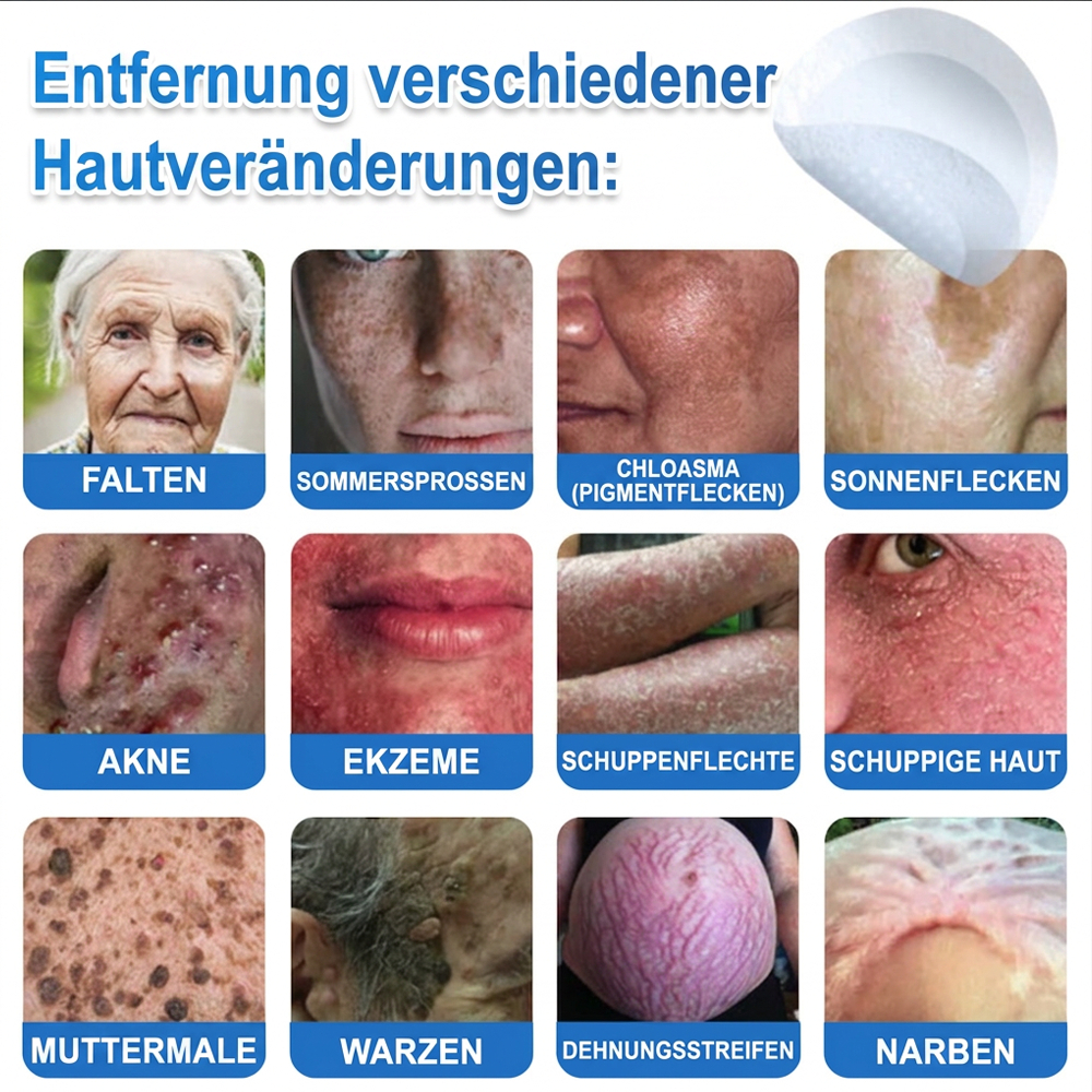 👩‍⚕️ Glimmerly® 2-in-1 Mikronadel- & Hydrokolloid-Pflaster ❄️ Entferner für erhabene Muttermale, Akne, flache Warzen & Hautanhängsel | Verbessert Falten, Narben & Hautunreinheiten | Unsichtbare Stern-Pickelpflaster für Gesicht & Körper
