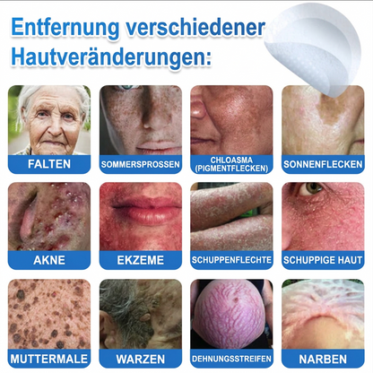 👩‍⚕️ Glimmerly® 2-in-1 Mikronadel- & Hydrokolloid-Pflaster ❄️ Entferner für erhabene Muttermale, Akne, flache Warzen & Hautanhängsel | Verbessert Falten, Narben & Hautunreinheiten | Unsichtbare Stern-Pickelpflaster für Gesicht & Körper