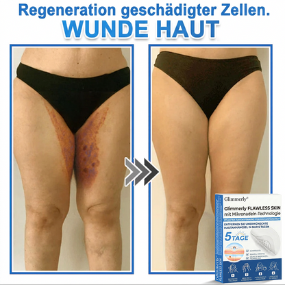 👩‍⚕️ Glimmerly® 2-in-1 Mikronadel- & Hydrokolloid-Pflaster ❄️ Entferner für erhabene Muttermale, Akne, flache Warzen & Hautanhängsel | Verbessert Falten, Narben & Hautunreinheiten | Unsichtbare Stern-Pickelpflaster für Gesicht & Körper