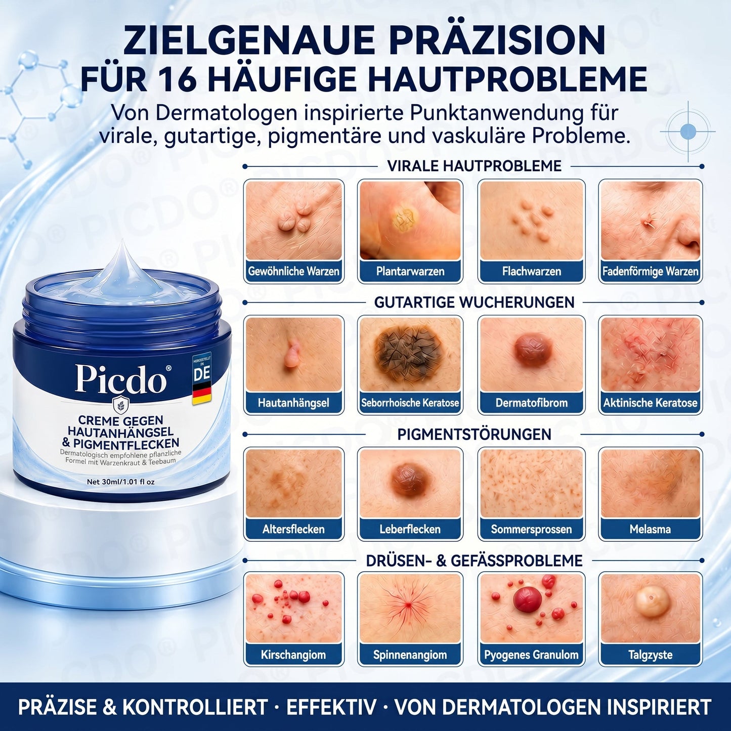 𝐏𝐢𝐜𝐝𝐨® 🥇 𝟕-𝐓𝐚𝐠𝐞 𝐇𝐚𝐮𝐭𝐚𝐧𝐡ä𝐧𝐠𝐬𝐞𝐥- & 𝐅𝐥𝐞𝐜𝐤𝐞𝐧-𝐄𝐧𝐭𝐟𝐞𝐫𝐧𝐮𝐧𝐠𝐬𝐜𝐫𝐞𝐦𝐞 (𝐒𝐜𝐡𝐦𝐞𝐫𝐳𝐟𝐫𝐞𝐢𝐞 𝐅𝐨𝐫𝐦𝐞𝐥 – 𝐨𝐡𝐧𝐞 𝐍𝐚𝐫𝐛𝐞𝐧)🔥