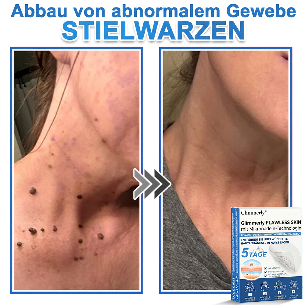 👩‍⚕️ Glimmerly® 2-in-1 Mikronadel- & Hydrokolloid-Pflaster ❄️ Entferner für erhabene Muttermale, Akne, flache Warzen & Hautanhängsel | Verbessert Falten, Narben & Hautunreinheiten | Unsichtbare Stern-Pickelpflaster für Gesicht & Körper