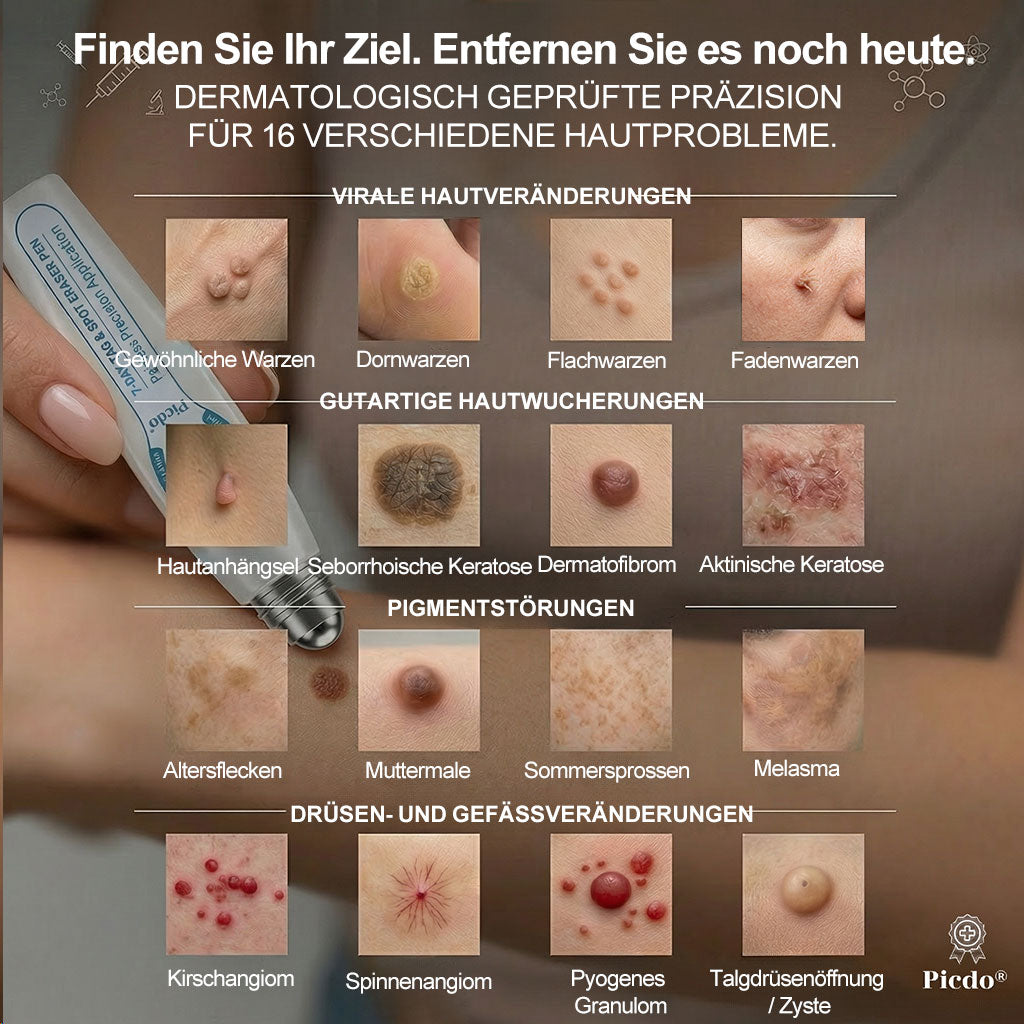 Offizieller Markenstore |🍟𝑷𝑖𝒄𝐝𝐨® 7-𝑻𝒂𝒈𝒆 𝑯𝒂𝒖𝒕𝒂𝒏𝒉ä𝒏𝒈𝒔𝒆𝒍- & 𝑭𝒍𝒆𝒄𝒌𝒆𝒏𝒆𝒏𝒕𝒇𝒆𝒓𝒏𝒆𝒓(Schmerzfreier Rollerball – Keine Narbenbildung)🥙