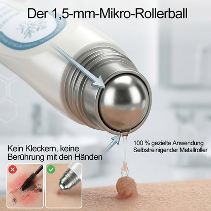 Offizieller Markenstore |🍟𝑷𝑖𝒄𝐝𝐨® 7-𝑻𝒂𝒈𝒆 𝑯𝒂𝒖𝒕𝒂𝒏𝒉ä𝒏𝒈𝒔𝒆𝒍- & 𝑭𝒍𝒆𝒄𝒌𝒆𝒏𝒆𝒏𝒕𝒇𝒆𝒓𝒏𝒆𝒓(Schmerzfreier Rollerball – Keine Narbenbildung)🥙