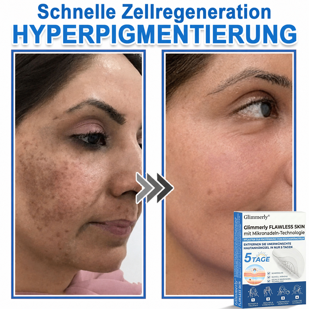 👩‍⚕️ Glimmerly® 2-in-1 Mikronadel- & Hydrokolloid-Pflaster ❄️ Entferner für erhabene Muttermale, Akne, flache Warzen & Hautanhängsel | Verbessert Falten, Narben & Hautunreinheiten | Unsichtbare Stern-Pickelpflaster für Gesicht & Körper
