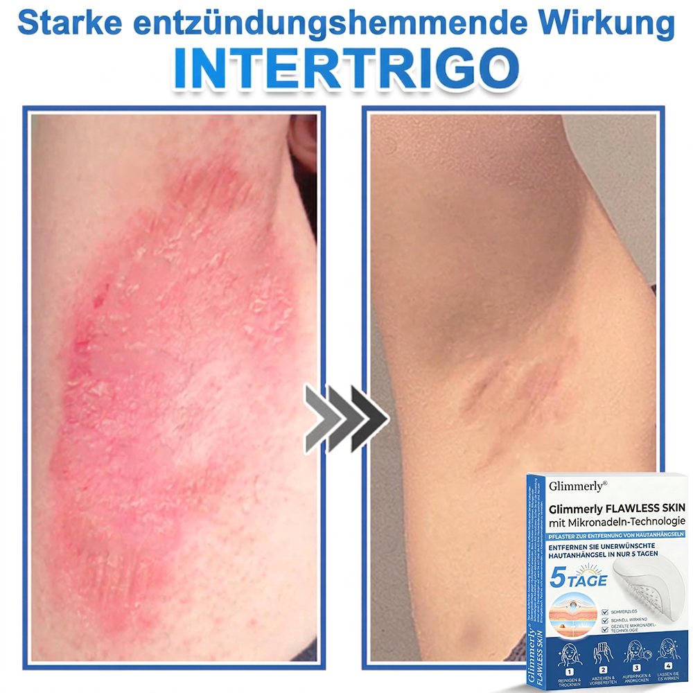 👩‍⚕️ Glimmerly® 2-in-1 Mikronadel- & Hydrokolloid-Pflaster ❄️ Entferner für erhabene Muttermale, Akne, flache Warzen & Hautanhängsel | Verbessert Falten, Narben & Hautunreinheiten | Unsichtbare Stern-Pickelpflaster für Gesicht & Körper