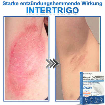 👩‍⚕️ Glimmerly® 2-in-1 Mikronadel- & Hydrokolloid-Pflaster ❄️ Entferner für erhabene Muttermale, Akne, flache Warzen & Hautanhängsel | Verbessert Falten, Narben & Hautunreinheiten | Unsichtbare Stern-Pickelpflaster für Gesicht & Körper